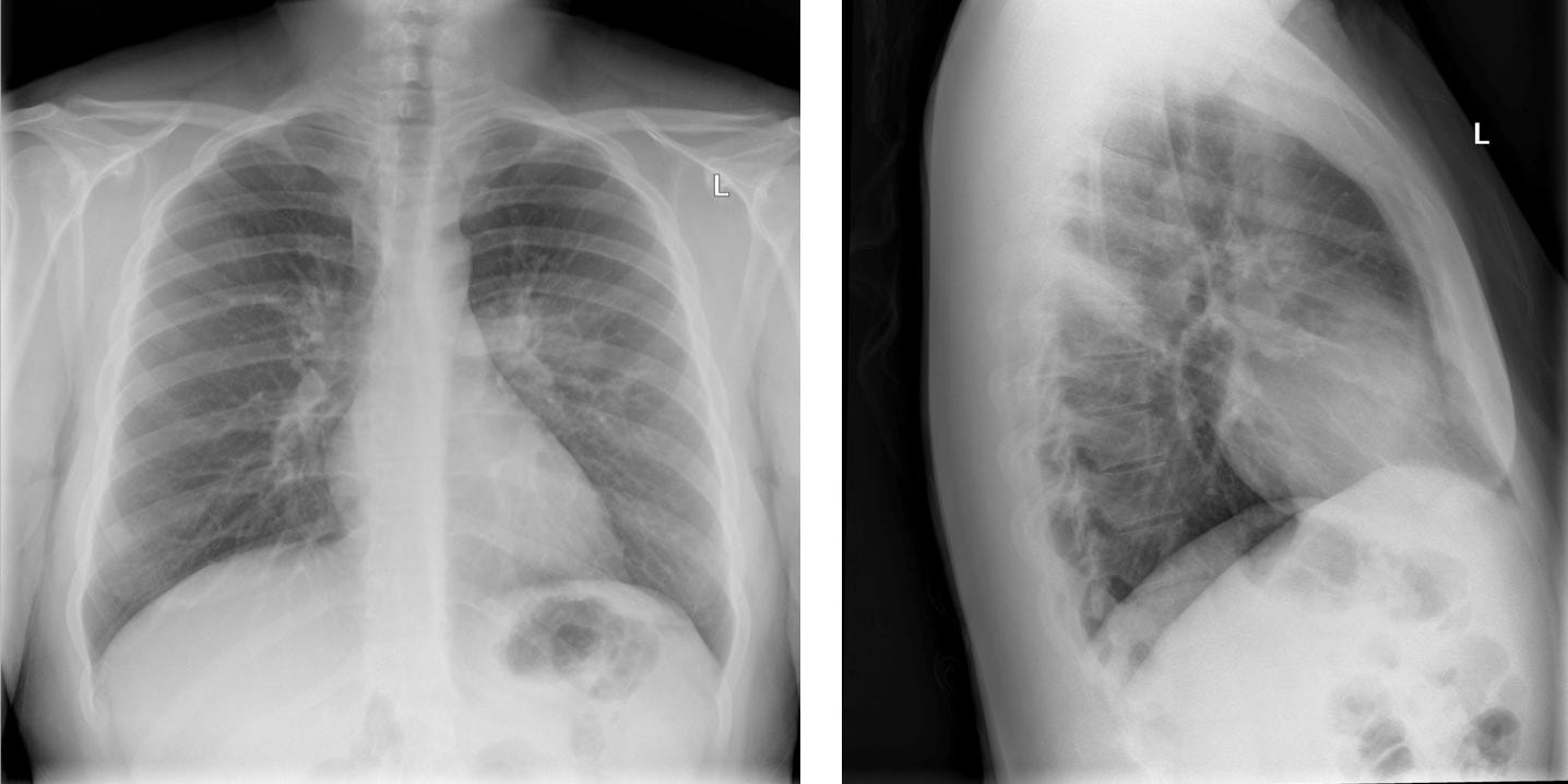 Radiographie standard